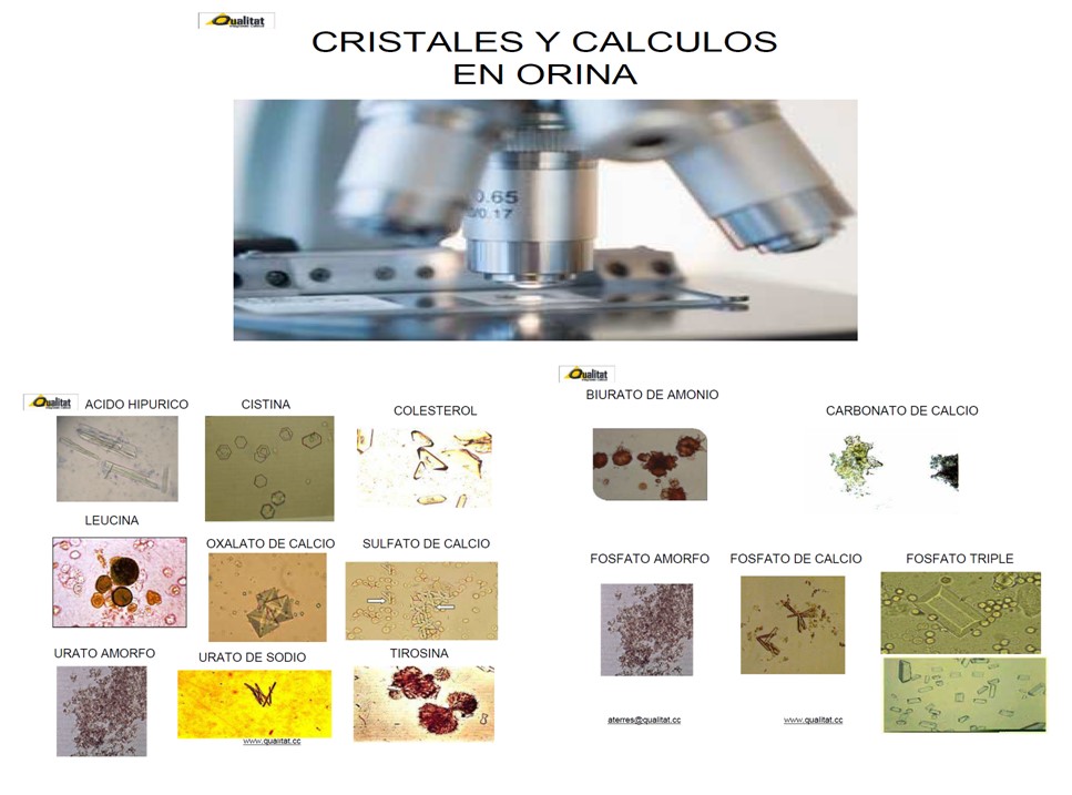 URIANALISIS.CRISTELES..jpg